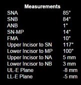 measurements